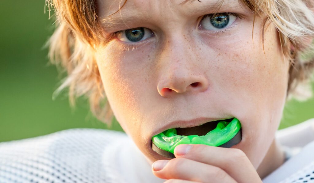 mouthguards