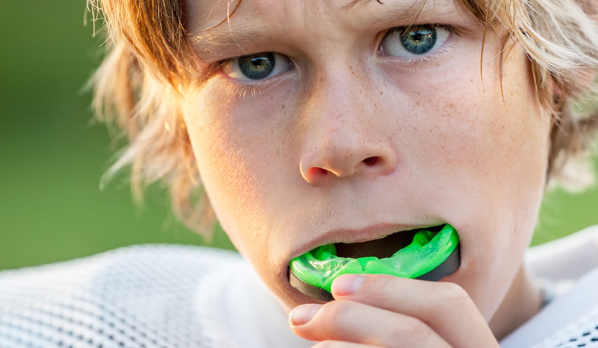 mouthguards