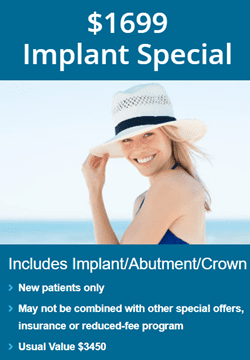 ental implants special offer